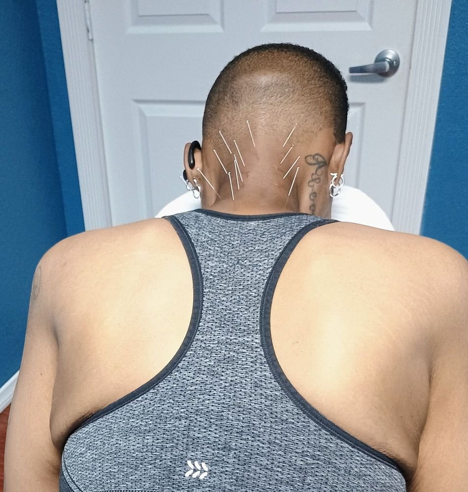 Alcocer Acupuncture Medical Clinic