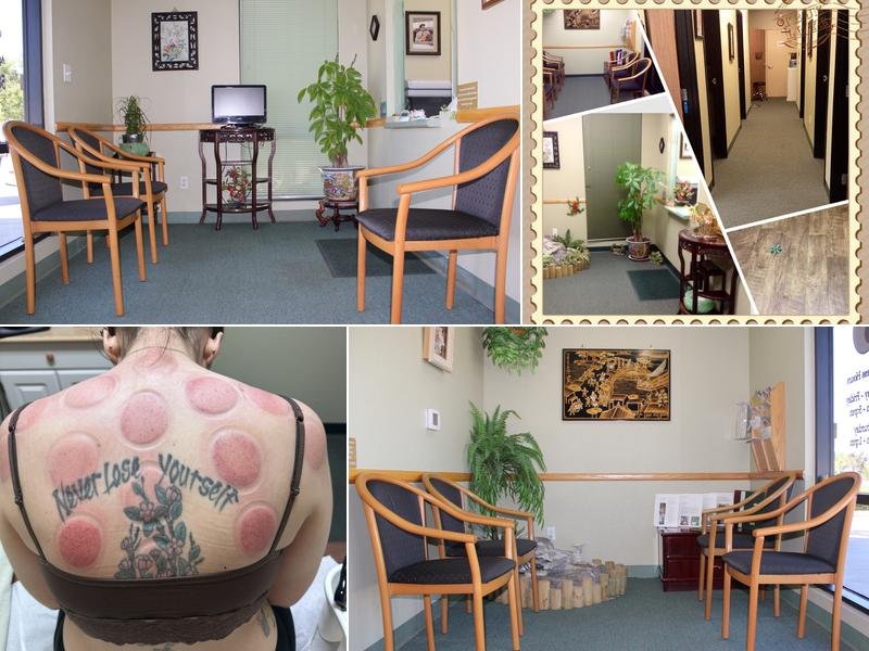 Rainbow Acupuncture